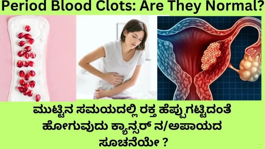 Period Blood Clots: What They Look Like and Signs to Watch