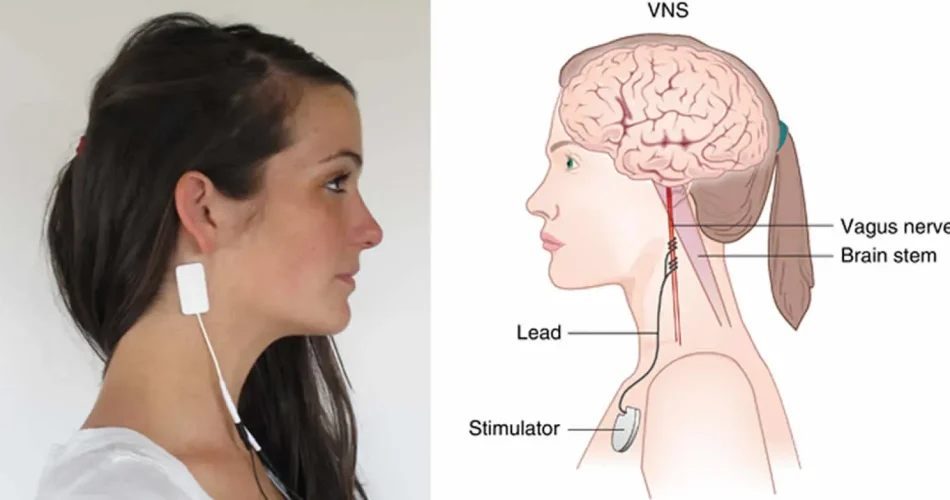 image_RZMNB6WS79webp